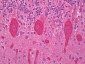 PRKCG / PKC-Gamma Antibody